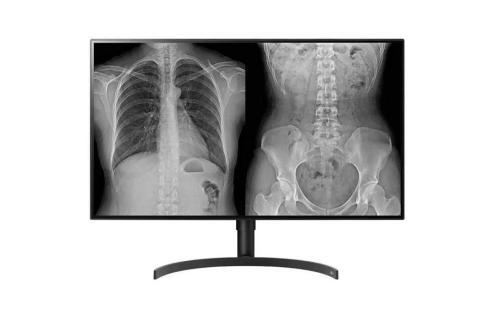 Lg Monitor Diagnostico LED Ips 32" (31.5) 8mp Uhd.